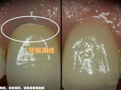 -团圆口腔·种植中心(锦江院区)
