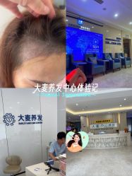 -大麦微针植发丨全国连锁