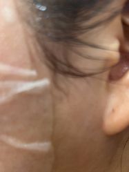 -美瑞莎创美医疗美容