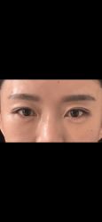 点击看大图 -Yestar艺星整形美容医院
