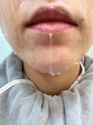点击看大图 体验后-北京英煌医疗美容