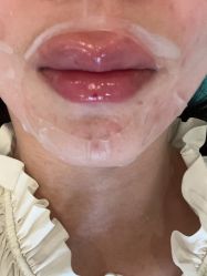 体验后-北京米扬丽格医疗美容·联合丽格鼻整形中心