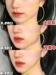 -上海漾颜医疗美容