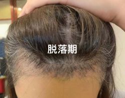 -熙朵美学植发·连锁品牌