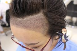 -大麦微针植发丨全国连锁