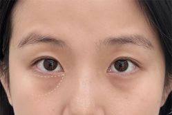 -Yestar艺星医疗美容医院