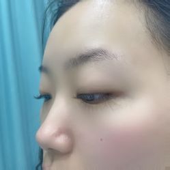 -郡艺医疗美容·微整·眼鼻吸脂