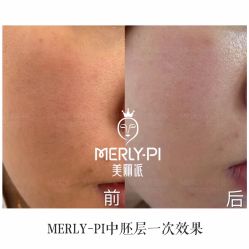 -MLP美丽派·问题肌疗愈中心