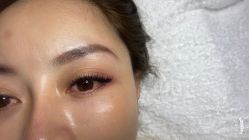 -CHUXIN初心·敏感·痘痘修护中心