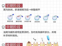 -上海仁爱医院口腔科 · 种植