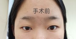 -八大处整形