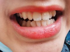 -Dr.Z dental仁康种植矫正中心