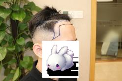 -大麦微针植发丨全国连锁