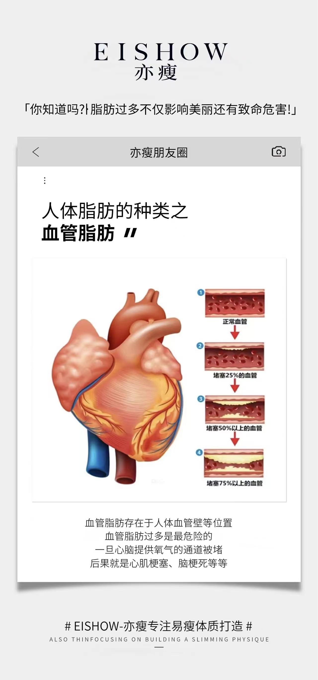 皮下脂肪和内脏脂肪图片