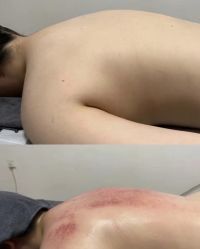 -智丽佳人祛斑祛痘美容美体