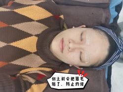 体验前-洁铭新加坡医美