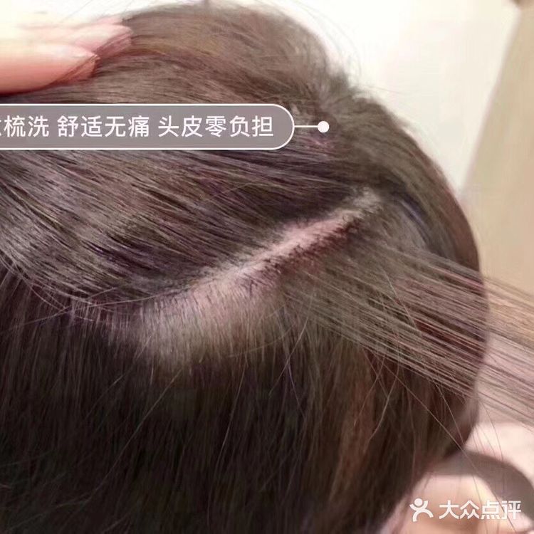 物理接发 增量 减龄