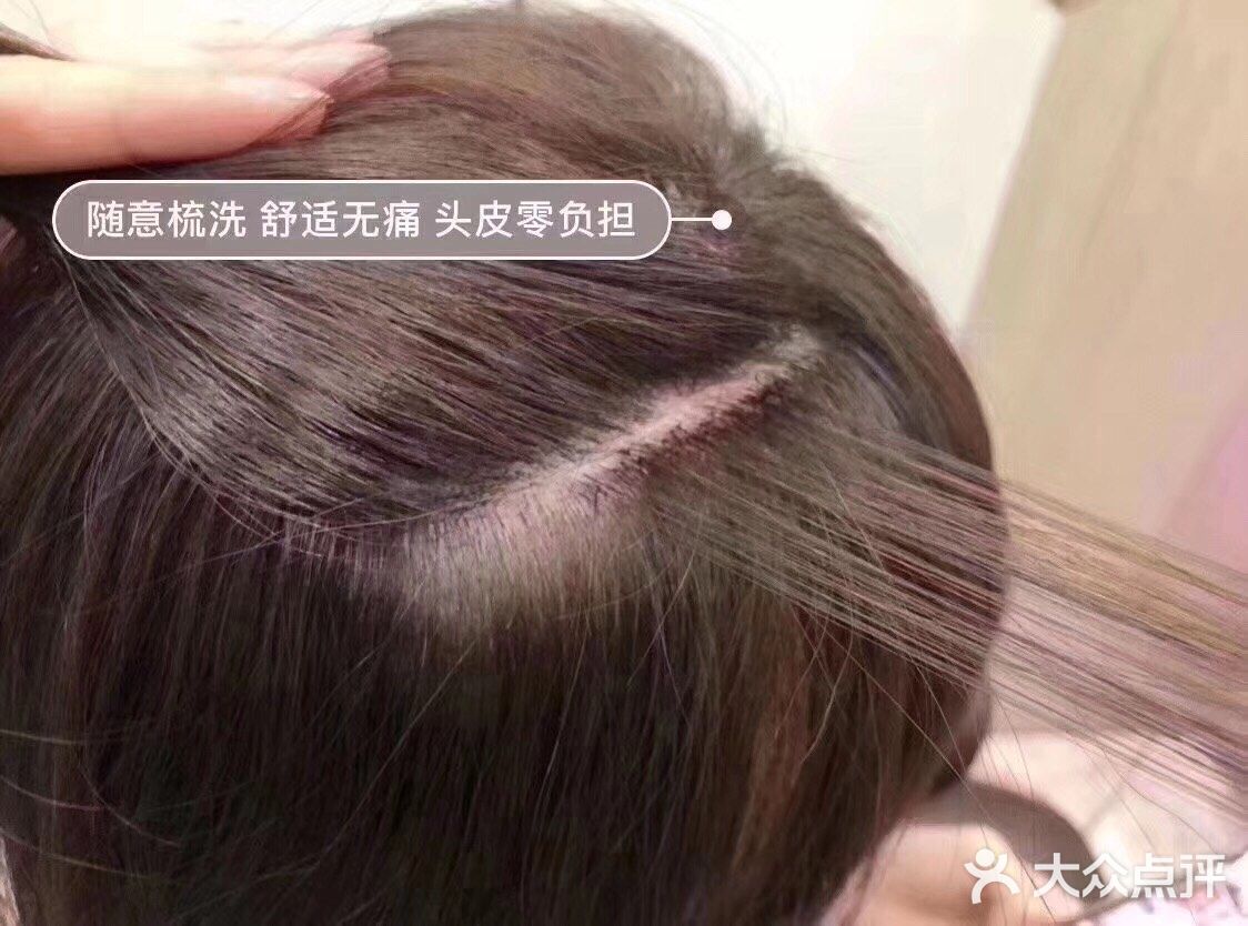 物理接发 增量 减龄