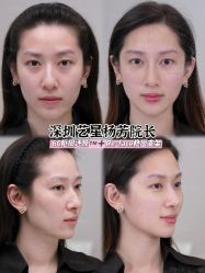 -深圳艺星医疗美容医院
