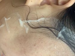 -美瑞莎创美医疗美容
