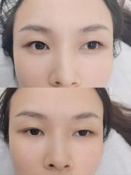 -西施无菌半永久纹绣眉眼影唇轻增发纹发际线