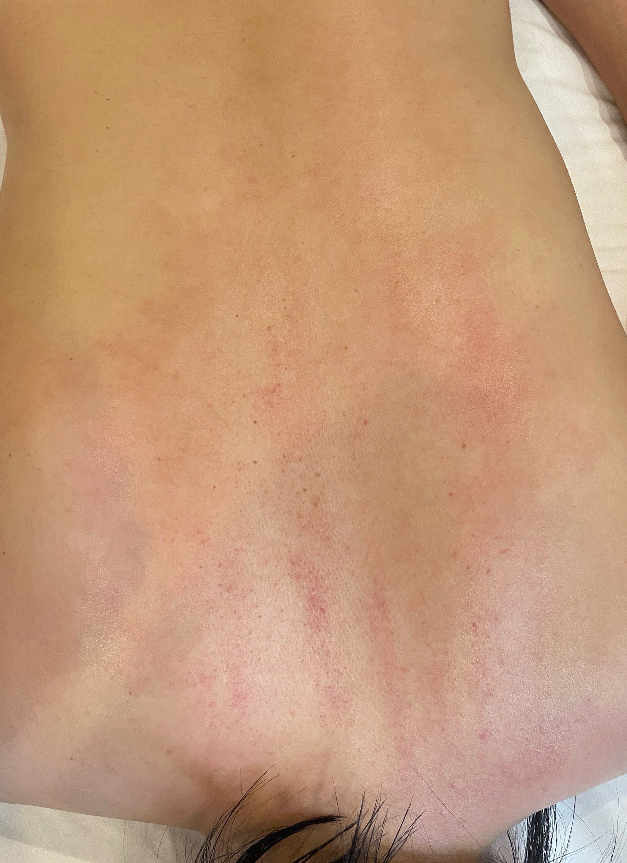 揭秘背部保养的小技巧