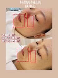 -美肤盾祛痘·问题肌头疗管理中心