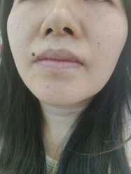 -长沙雅美医疗美容医院