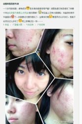 门面-苗方清颜专业祛痘