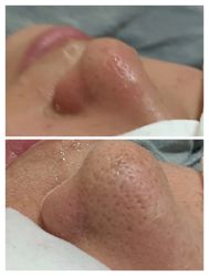 -艾尚妮·美容美体SPA