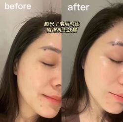 -LUNA皮相美·骨相美高级美感