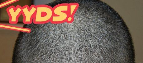 -大麦微针植发丨全国连锁