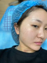体验前-天津伊美尔医疗整形美容专科医院