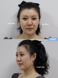-Yestar艺星医疗美容医院