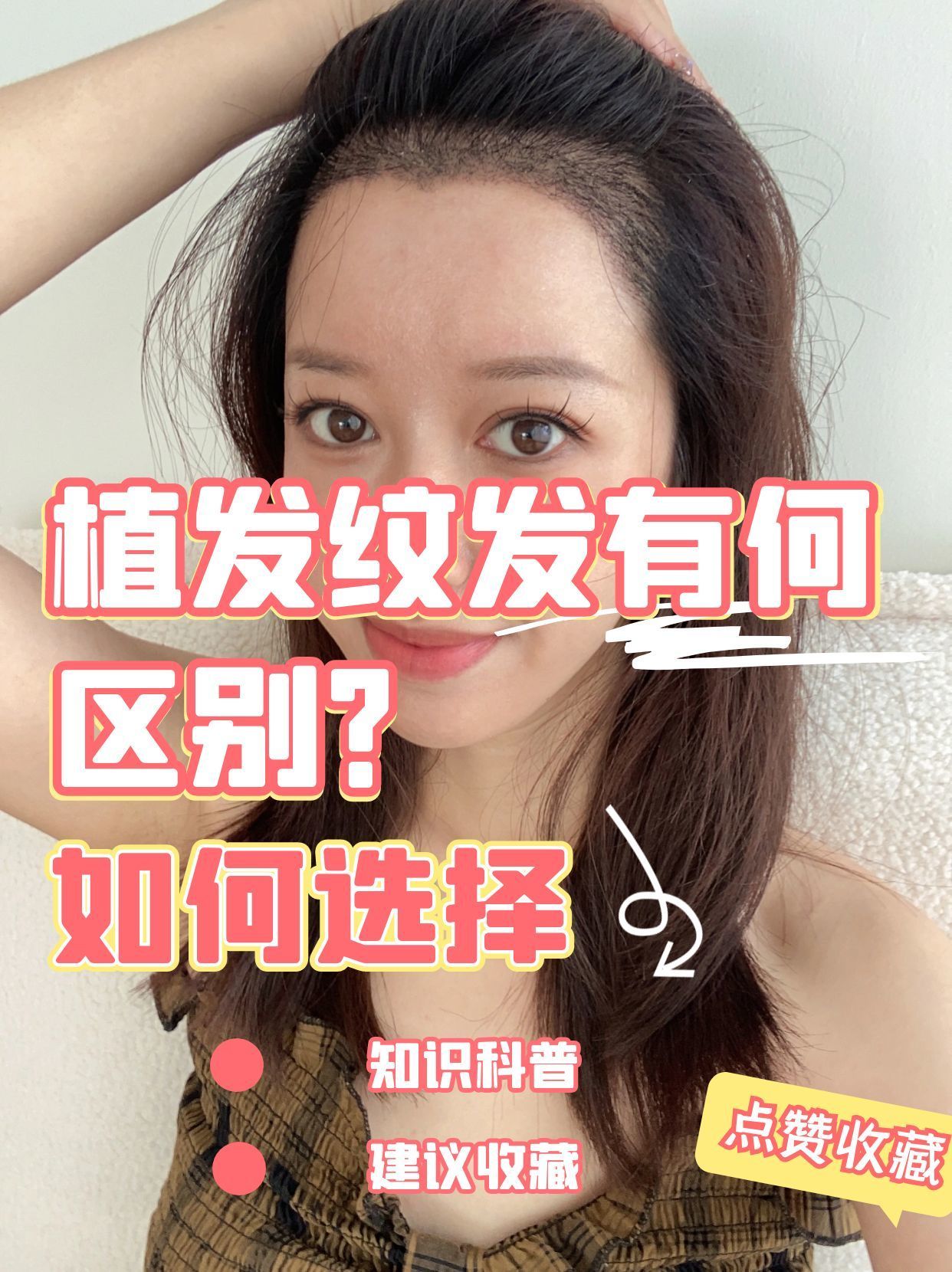 植发纹发有何区别?如何选择