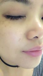 点击看大图 -MedSkinCare科技祛痘肌肤修护中心