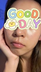 -北京米扬丽格医疗美容·联合丽格鼻整形中心