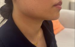 -长沙雅美医疗美容医院