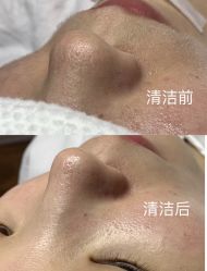 -美愈美肤MEIYU SKIN