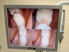 -爱贝口腔·牙周诊疗·种植修复中心