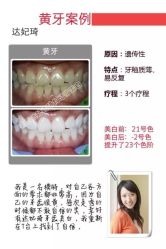 要想保持牙齿又白又健康 就来光SPA 找达妃琦 整个过程 安全 舒适 无痛 [害羞][害羞]-光SPA科技美肤