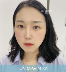 -久匠半永久纹眉