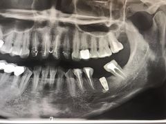 -希望齿科(河西店)