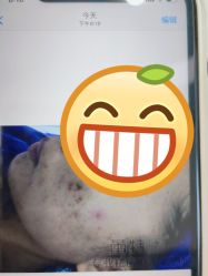 点击看大图 -蕾特恩专业祛痘·皮肤管理