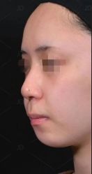 -素美医疗美容·西南眼鼻整形·修复基地