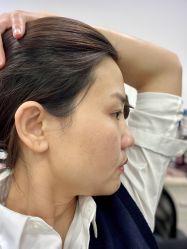 -北京美痣堂古方祛痣斑疣瘊