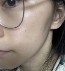 -演员的秘密·皮肤管理