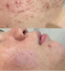 -痘庄科学祛痘国际连锁