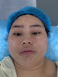 -agge蛋白医美