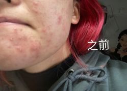 -郡艺医疗美容·微整·眼鼻吸脂